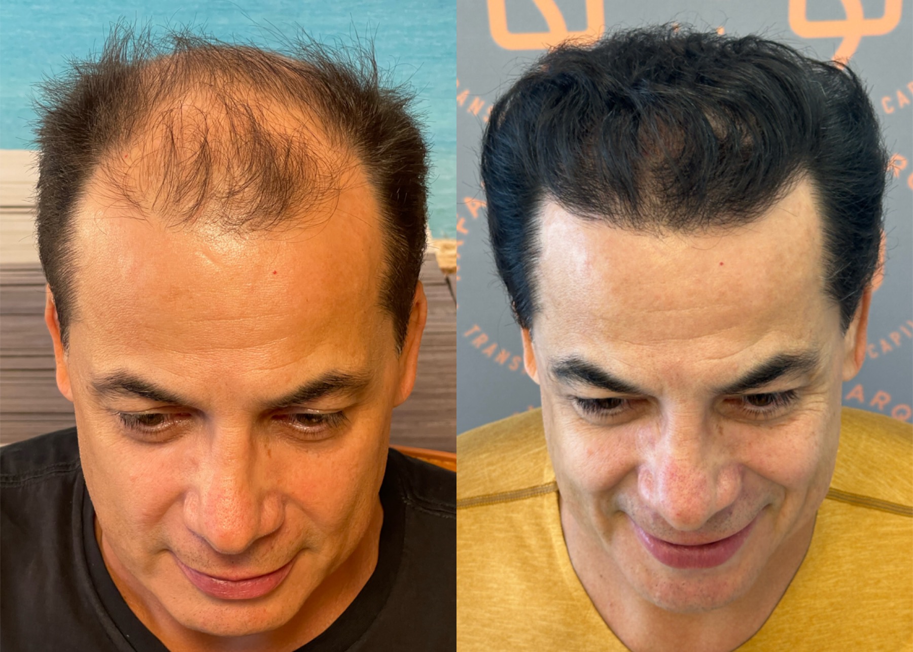antes e depois 01