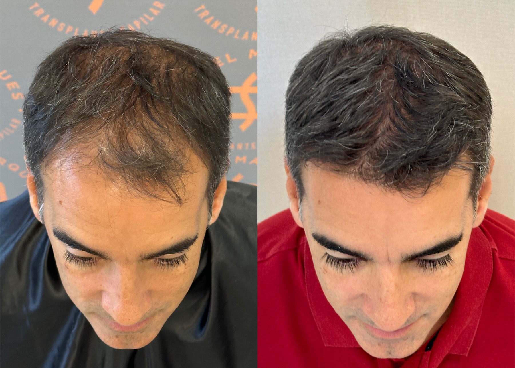 antes e depois 02
