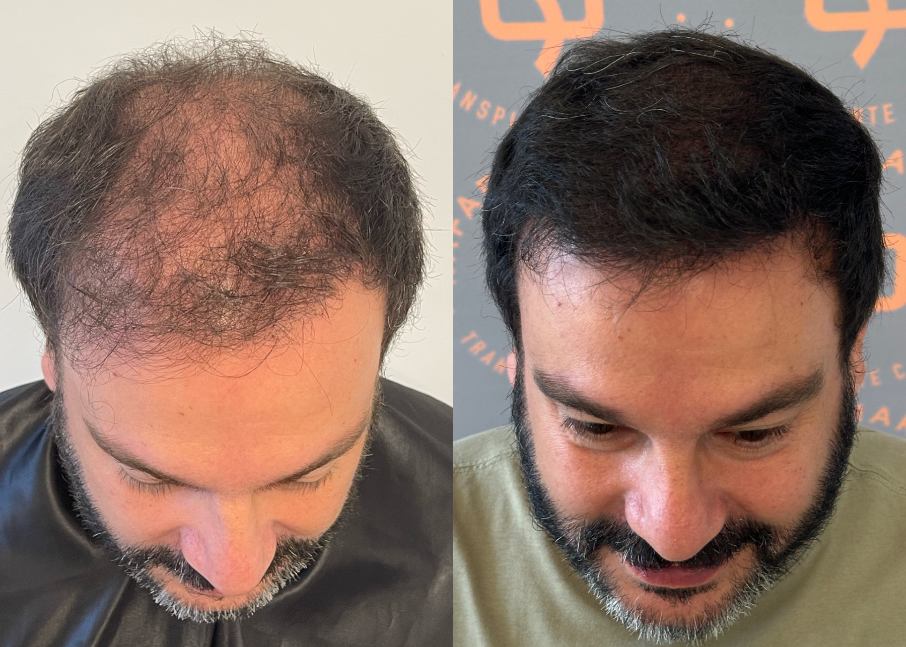 antes e depois 03