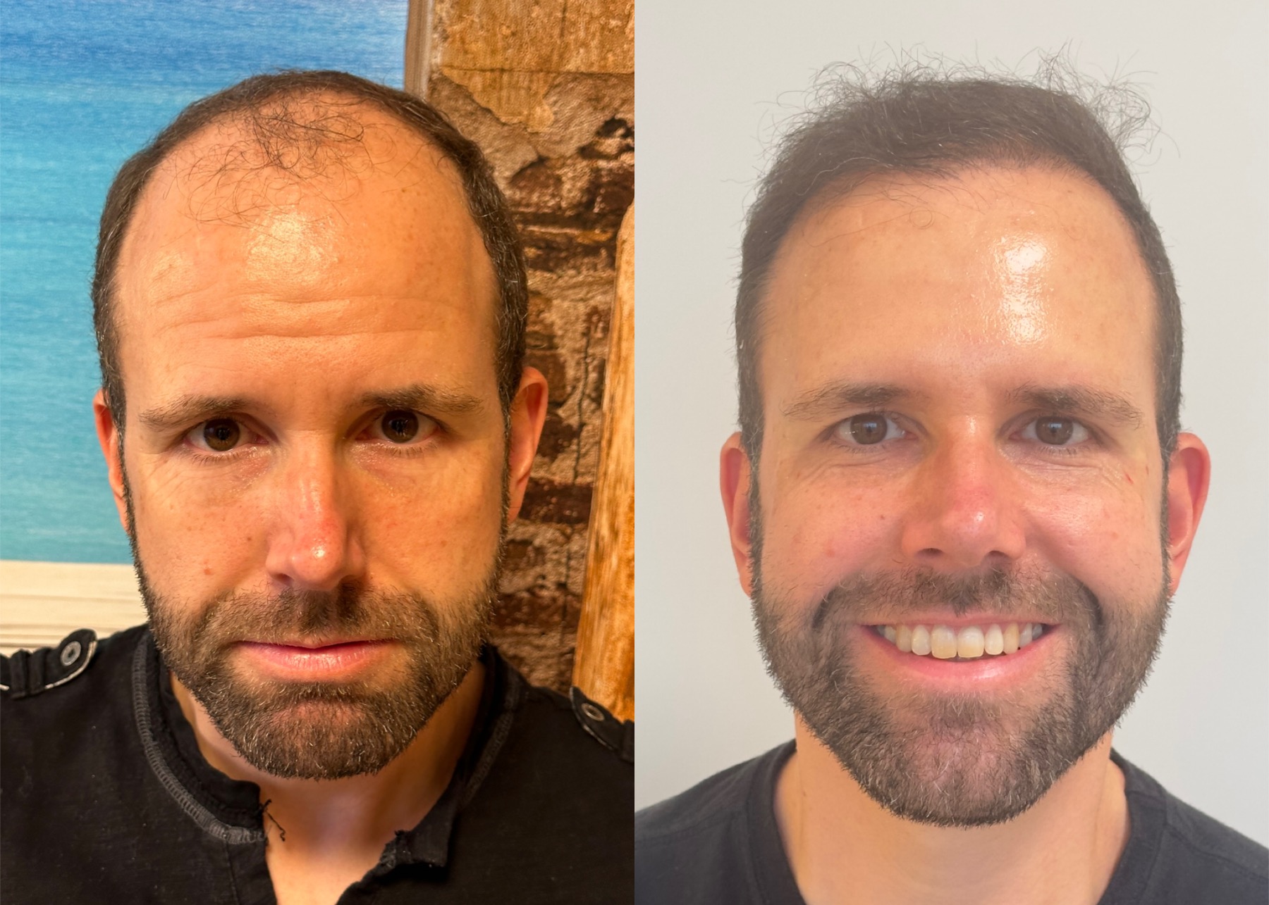 antes e depois 06